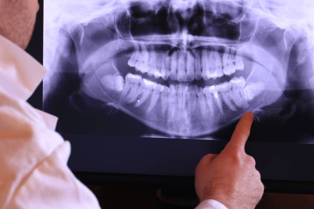 Best Urgent Care for Lost Fillings or Crowns in Rogers, AR