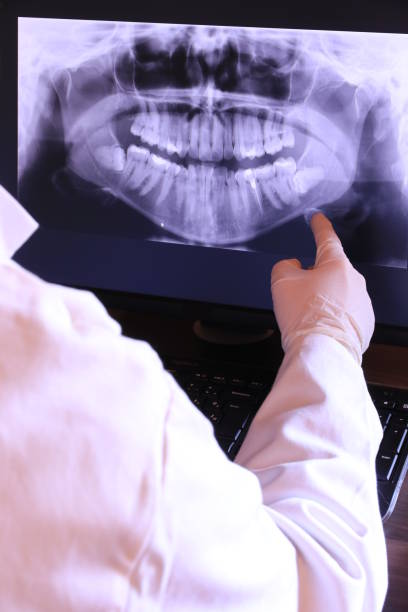 Best Emergency Dental Care for Broken or Chipped Teeth in Rogers, AR