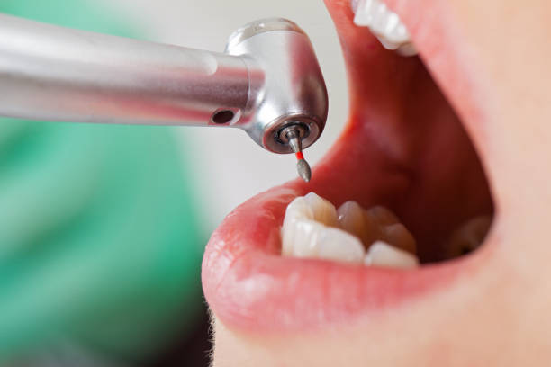 Best Emergency Gum Treatment in Rogers, AR